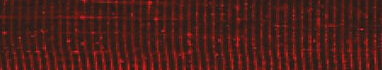 Skeletal muscle immunofluorescence, red channel
