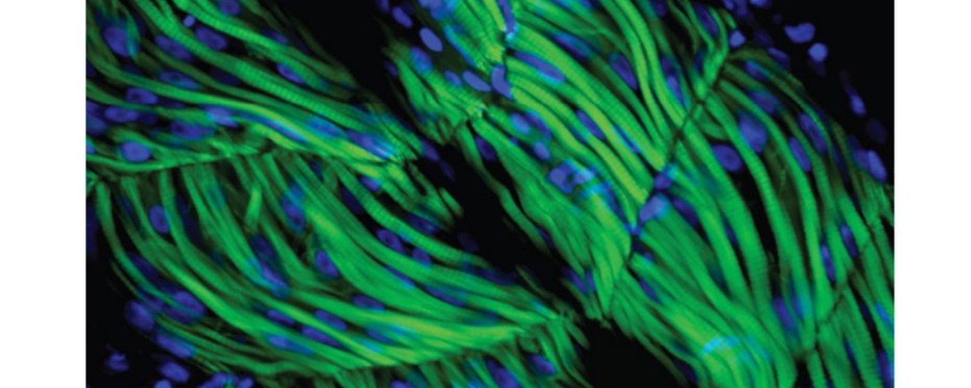 Skeletal muscle fluorescence microscopy