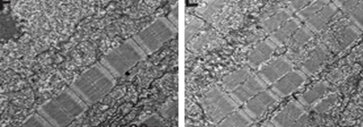 Electron microscopy of skeletal muscle sarcomeres from published KLHL41 study